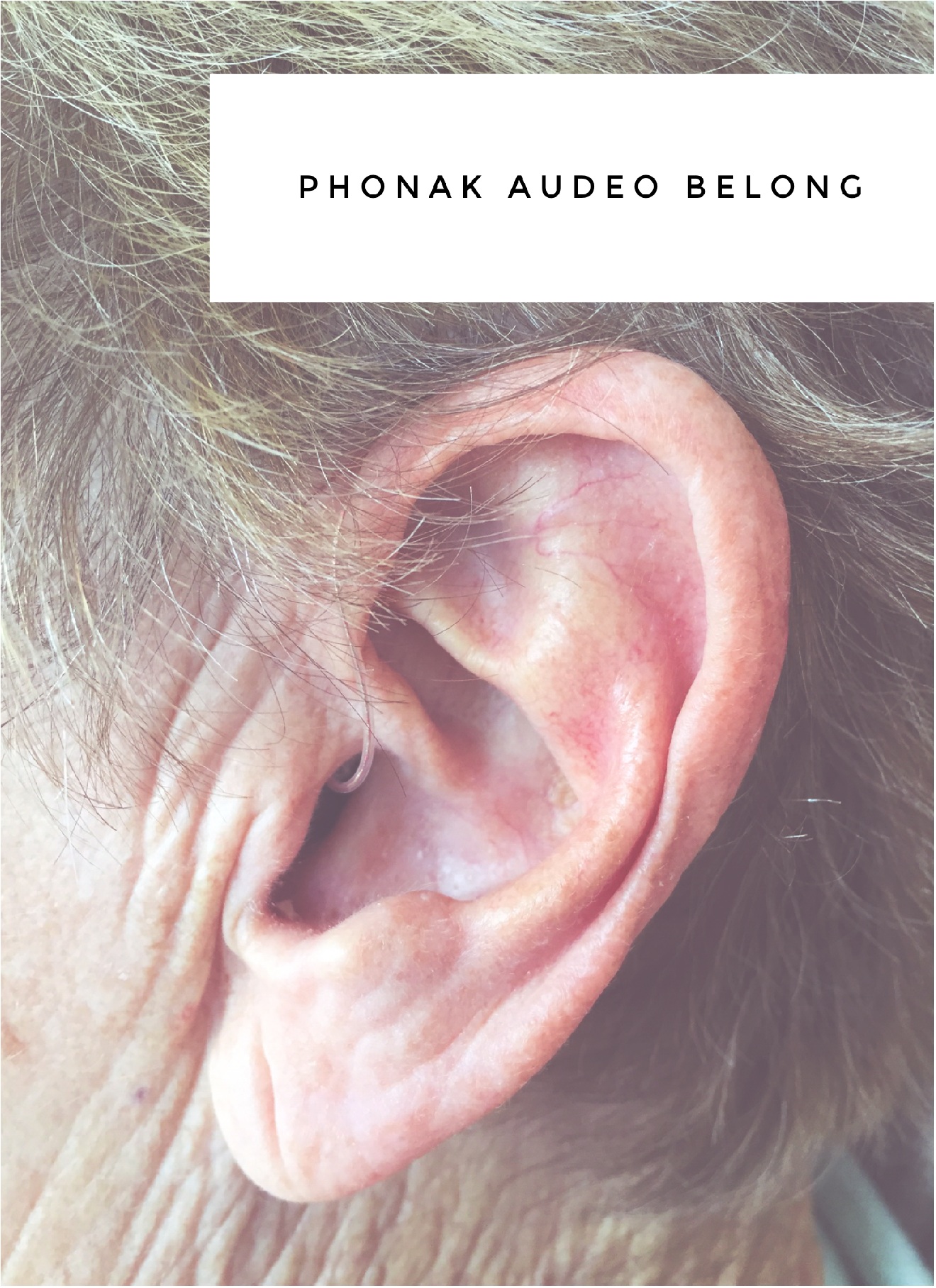 One of our happy customers wearing her new Phonak Audeo Belong hearing aid.